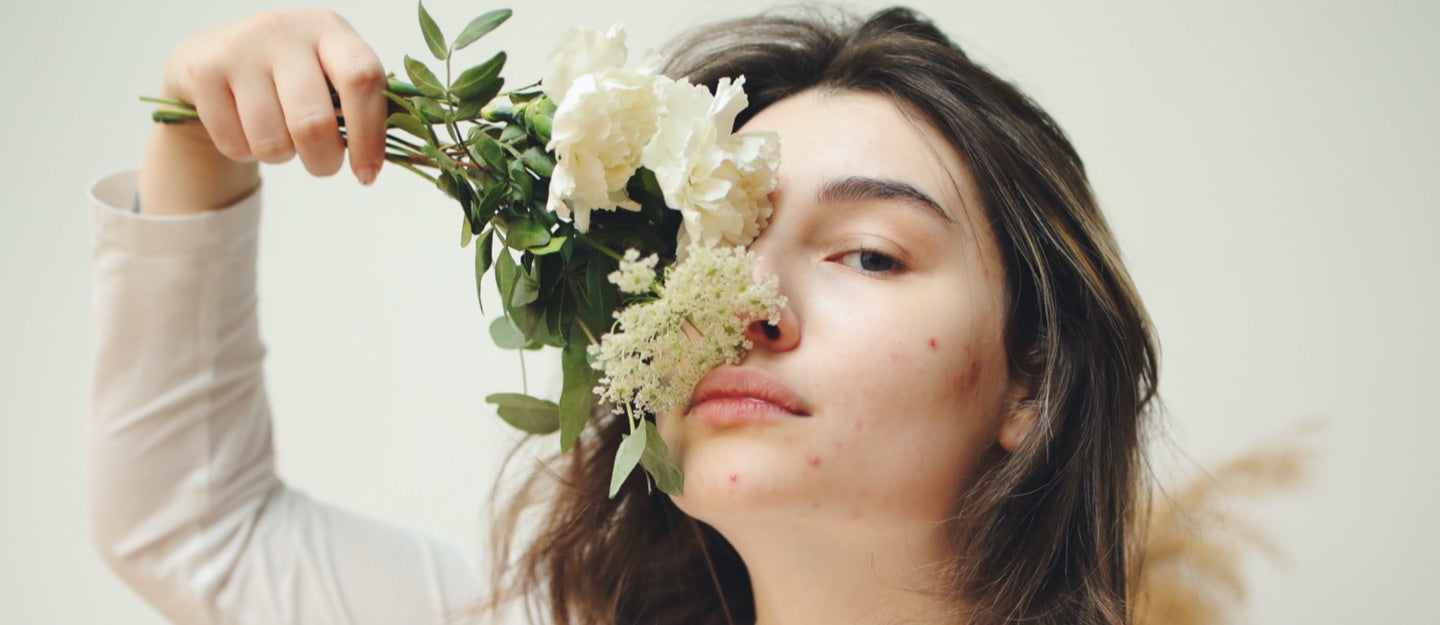 Begini Caranya Menghilangkan Bekas Jerawat – COTTONINK